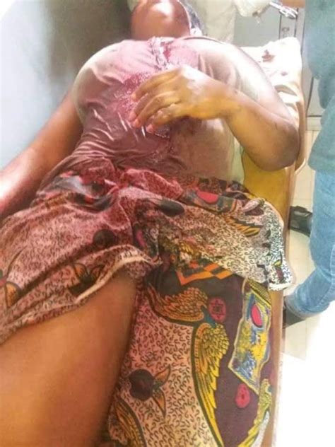 Landlord And Wife Arrested After Tenant S Face Was Slashed