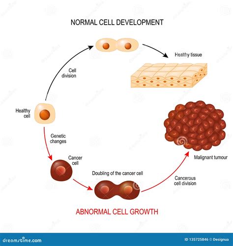 cancer cell illustration showing cancer disease development stock