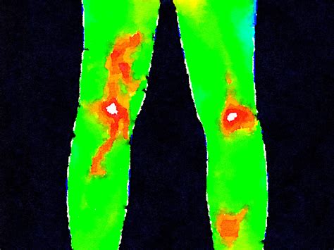 thermography family naturopathic clinic