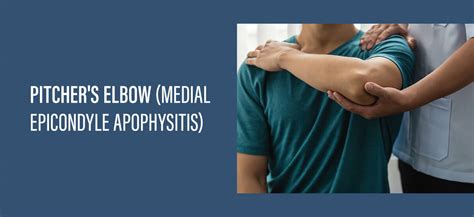 pitchers elbow medial epicondyle apophysitis hand center  louisiana