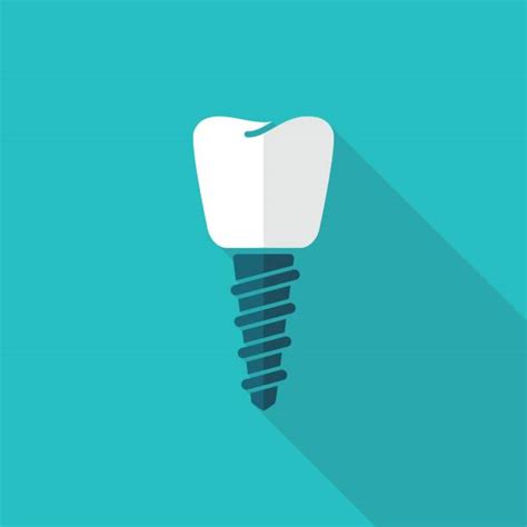 dental implant illustrations royalty free vector graphics and clip art
