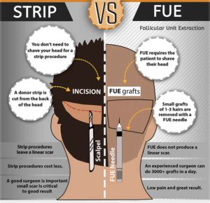 fut  fue method  differences    ways  treat hair loss