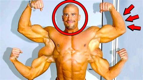 Top 10 Unusual People With Extra Body Parts Youtube