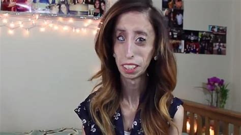 World S Ugliest Woman Faces Up To Online Bullies In Anti Bullying