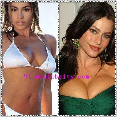 Sofia Vergara Plastic Surgery Before And After Photos