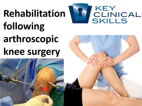 rehabilitation  arthroscopic knee surgery   key clinical skills