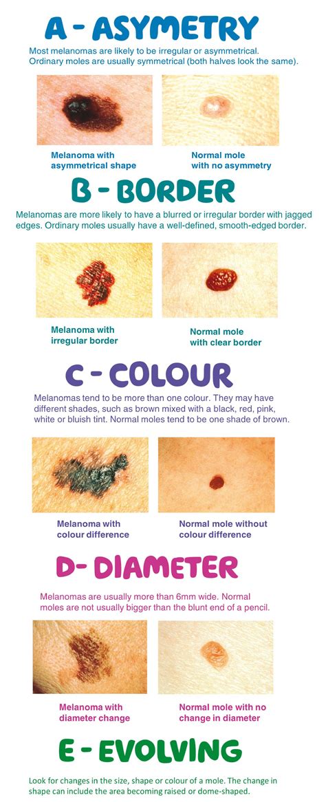 Skin Cancer Awareness Month – Signs Symptoms And Sun Protection