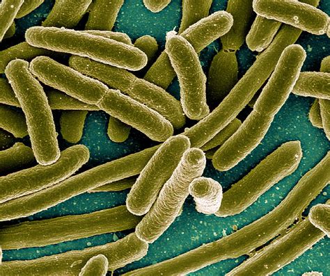 escherichia coli bacteria sem photograph  niaidcdc