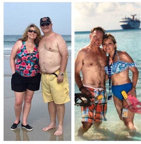 Couple Talks About Having Gastric Bypass Just Days Apart