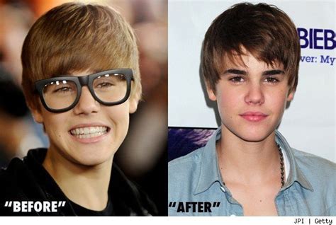 before and after justin bieber photo 18097750 fanpop
