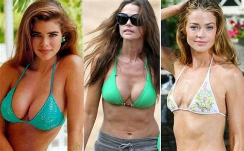 Denise Richards Before And After Plastic Surgery Boob Face