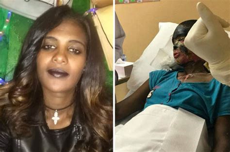 Acid Attack Wife Can Only Cry After Husband Throws