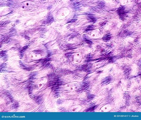 epidermis stratum spinosum desmosomes stock image image