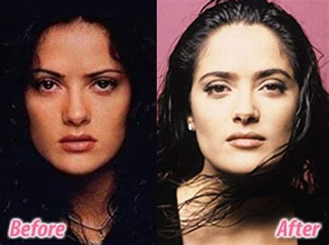 stars before and after plastic surgery 47 pics
