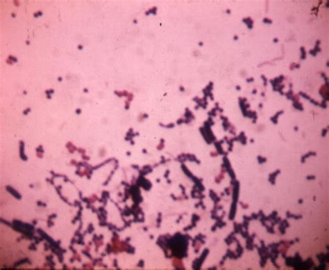 Bsci 424 Streptococcus Images