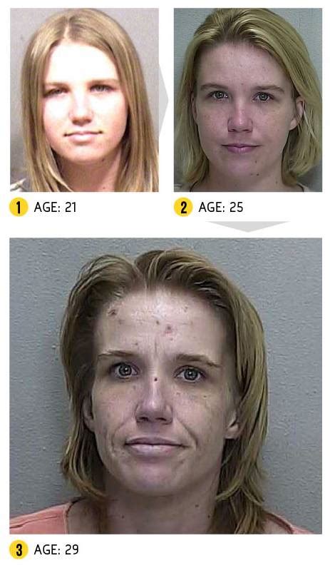 before and after meth addict pictures mugshots reveal