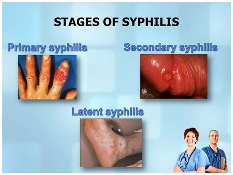 syphilis and oral sex tubezzz porn photos