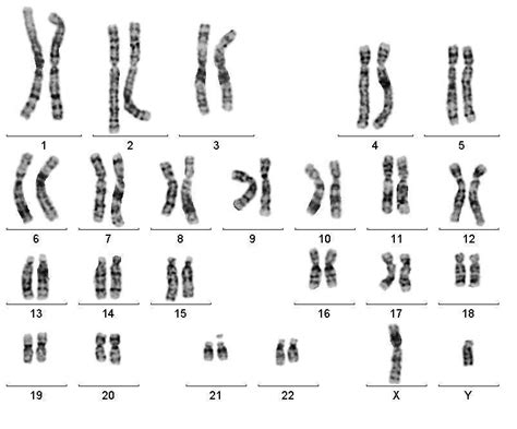 Normal Male Chromosomes And Karyogram 46 Xy Download Scientific