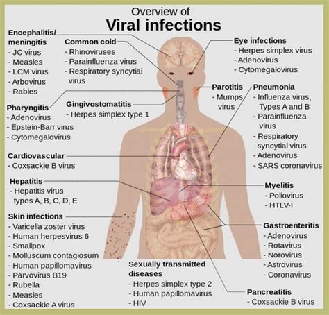 infection viral measles chicken pox mumps colds flu