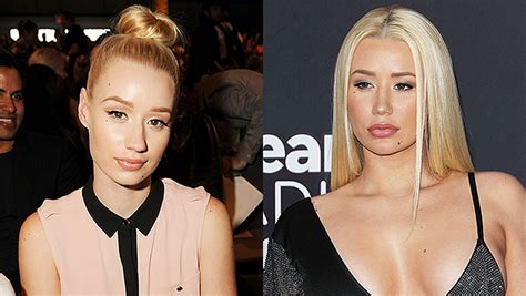 celebrity nose jobs photos stars who ve admitted to plastic surgery hollywood life