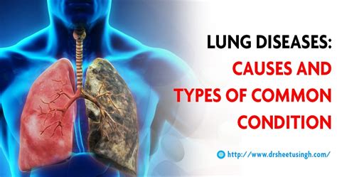 lung diseases types   breathing problem symptoms risk