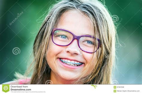 Happy Smiling Girl With Dental Braces And Glasses Young Cute Caucasian