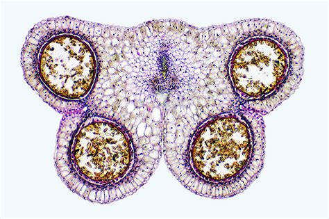 lily anther transverse section showing pollen sacs nikons small world