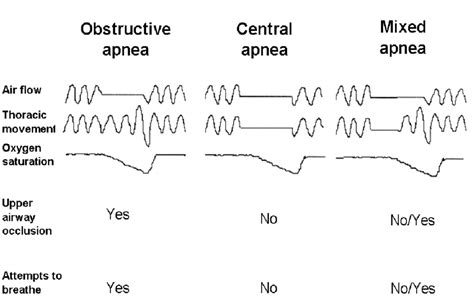 obstructive central  mixed apneas  scientific diagram