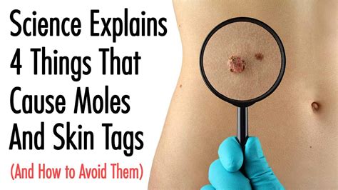 science explains 4 things that cause moles and skin tags and how to