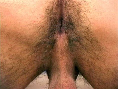 male anal bleaching penty photo