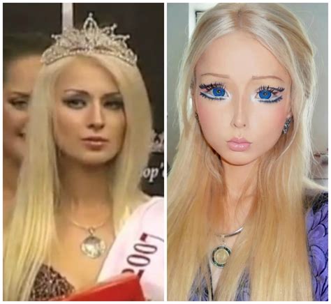 Valeria Lukyanova Plastic Surgery Before After Breast