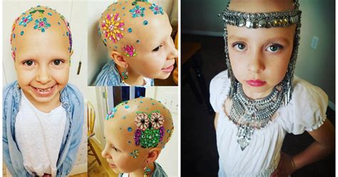 7 Year Old Girl With Alopecia Makes Her Baldness Beautiful Goes Viral
