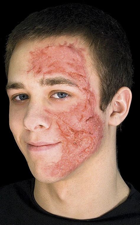 facial scars pictures gay and sex
