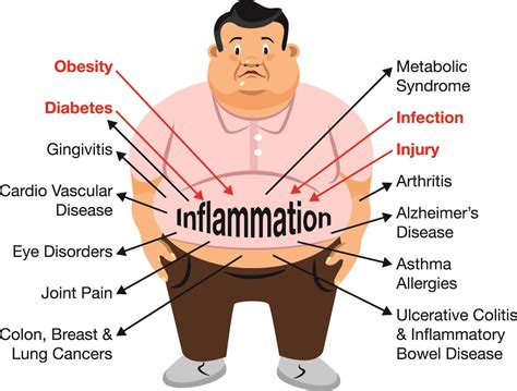 chronic inflammation disease begins   gut