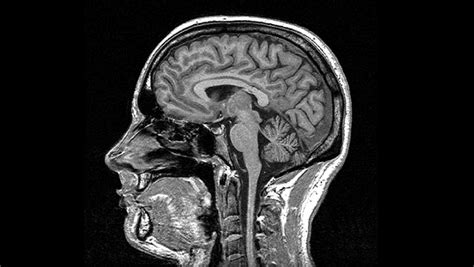 brain scans technologies  peer   head