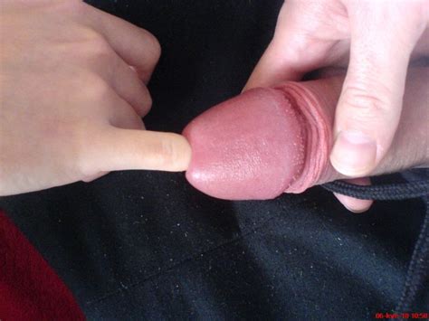 urethra penetration