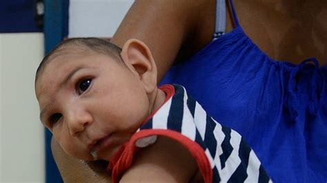 zika virus caused birth defects    infected women