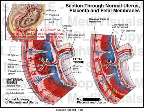 Medivisuals Section Through Normal Uterus Placenta And Fetal Membranes