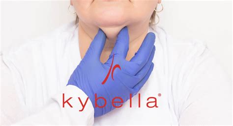 kybella cloud  medi spa   kybella healthcare specialist