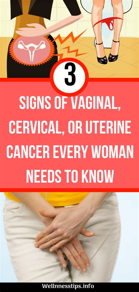 3 signs of vaginal cervical or uterine cancer every woman needs to