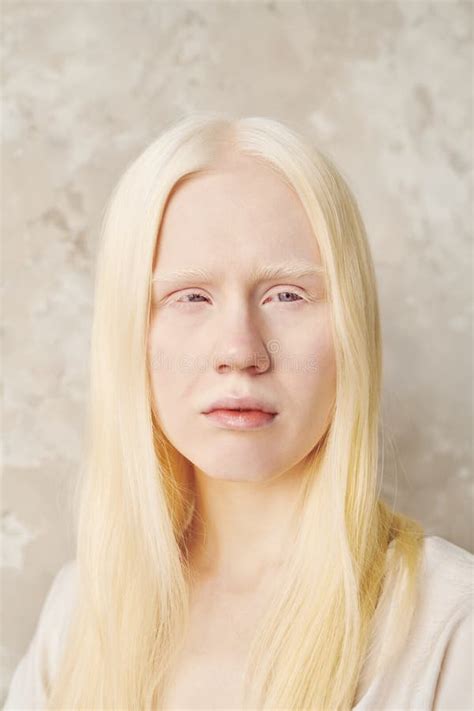 Adolescent Albino Girl With Long Smooth Hair Posing In Front Of Camera