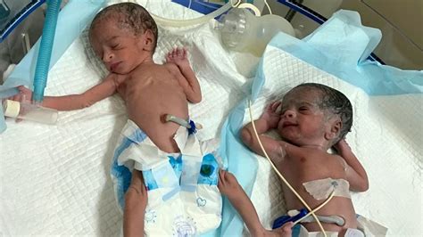 world s oldest mom gives birth to twins at age 74 hospital claims