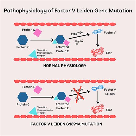 cureus factor  leiden ga  prothrombin gene ga mutations  pregnancy outcome