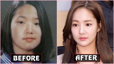 korean actress plastic surgery      xxx hot girl