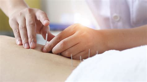 medicare  cover acupuncture treatments    pain
