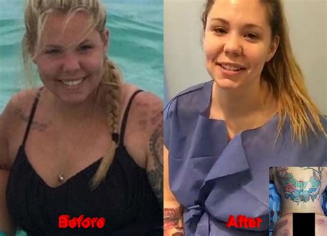 kailyn lowry and her new plastic surgery