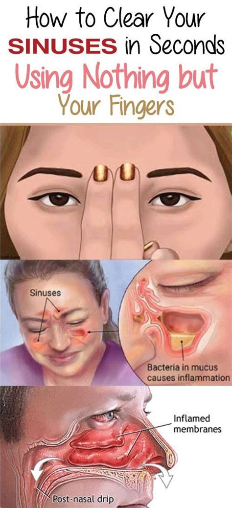 blocked sinuses are a common problem for people of all