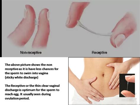 fertility solutions vaginal discharge and frequently