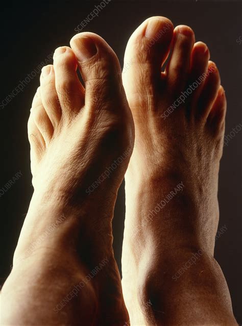 Top View Of A Man S Healthy Feet Stock Image P701 0127