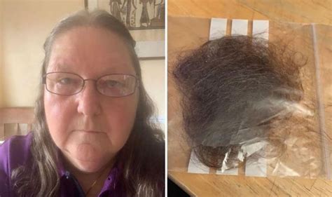 covid symptom grandmother describes  hair loss due  covid